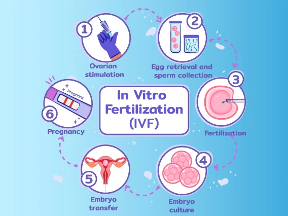 IVF Treatment Illustration