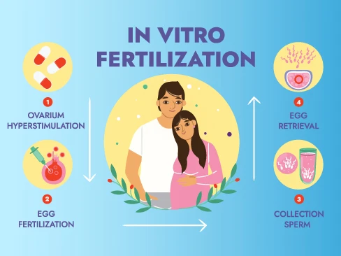 Illustration of IVF Process